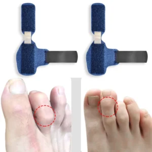 Toe Splint Straightener Corrector